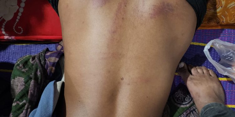 বটতৈল ইউনিয়নের খাজানগর গ্রামটা এখনো আওয়ামী লীগের নেতারা শোষণ করছে