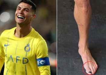 রোনালদো কেন পায়ে নেইলপলিশ লাগান