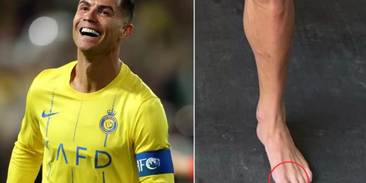 রোনালদো কেন পায়ে নেইলপলিশ লাগান