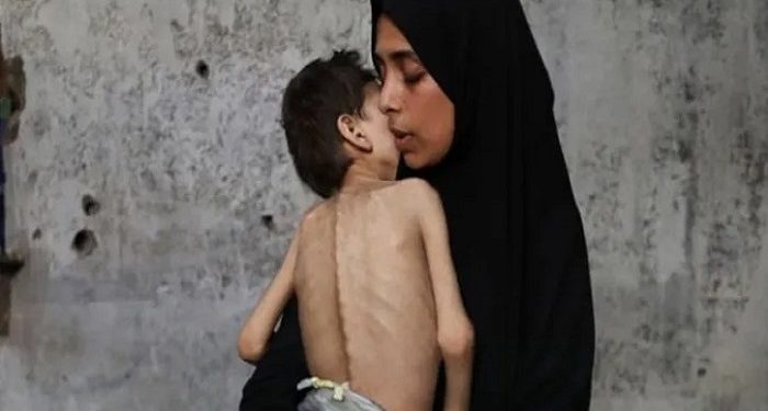 ‘আমরা ধীরে ধীরে মারা যাচ্ছি’