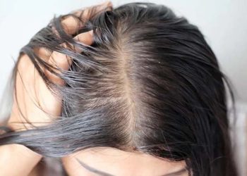 মাথার ত্বকের সমস্যা দূর করার ঘরোয়া উপায়